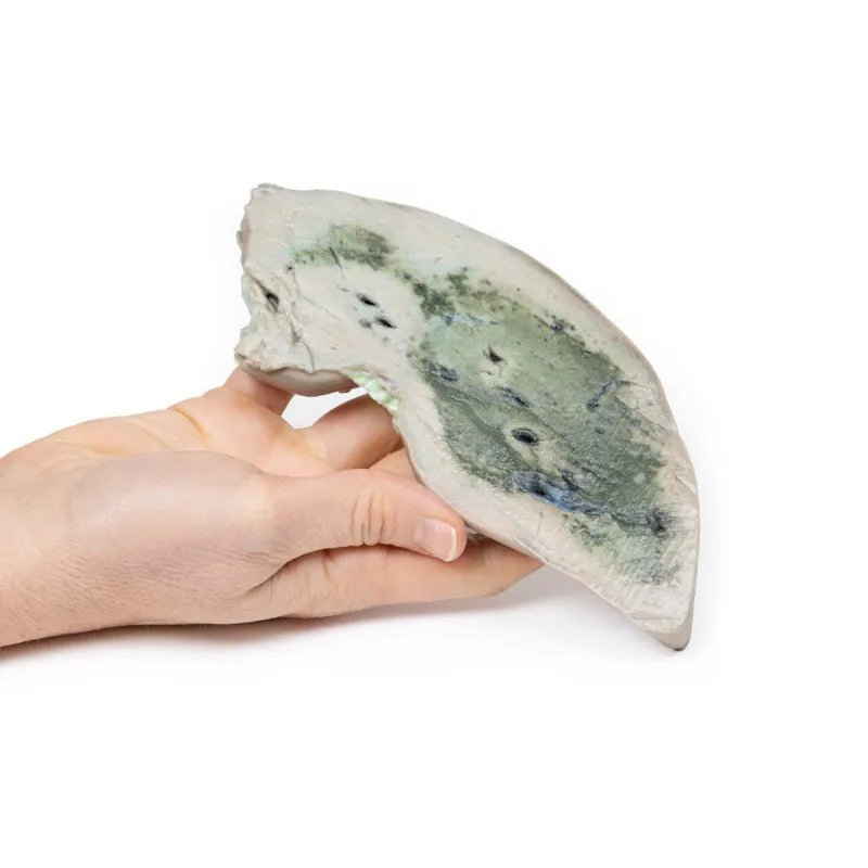 3D Printed Fatty Liver