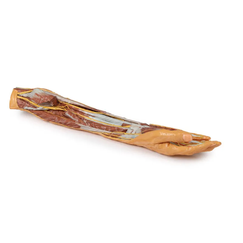 3D Printed Forearm and Hand Replica - Superficial and Deep Dissection