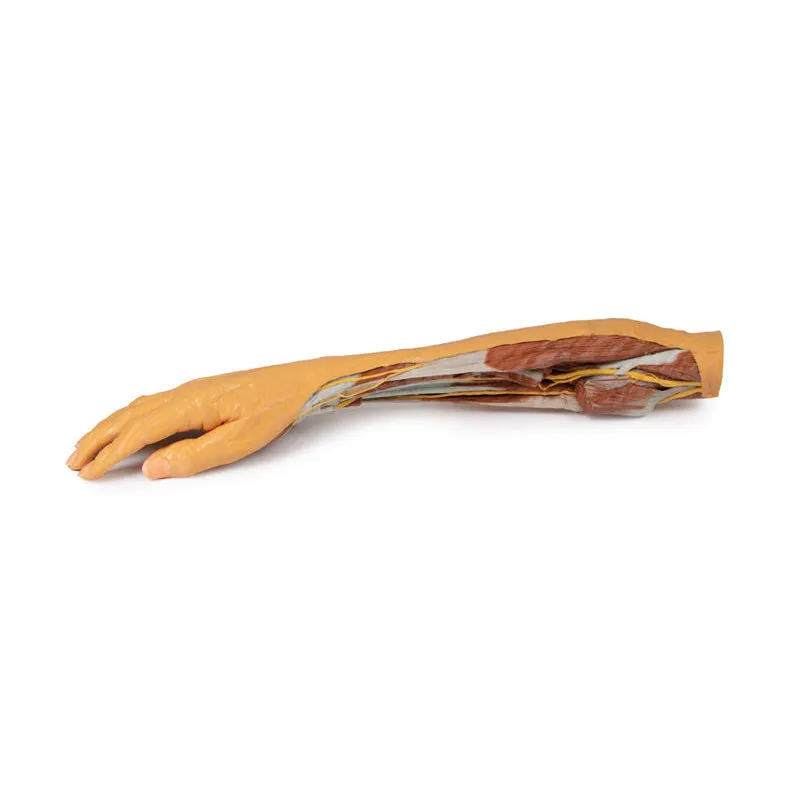 3D Printed Forearm and Hand Replica - Superficial and Deep Dissection